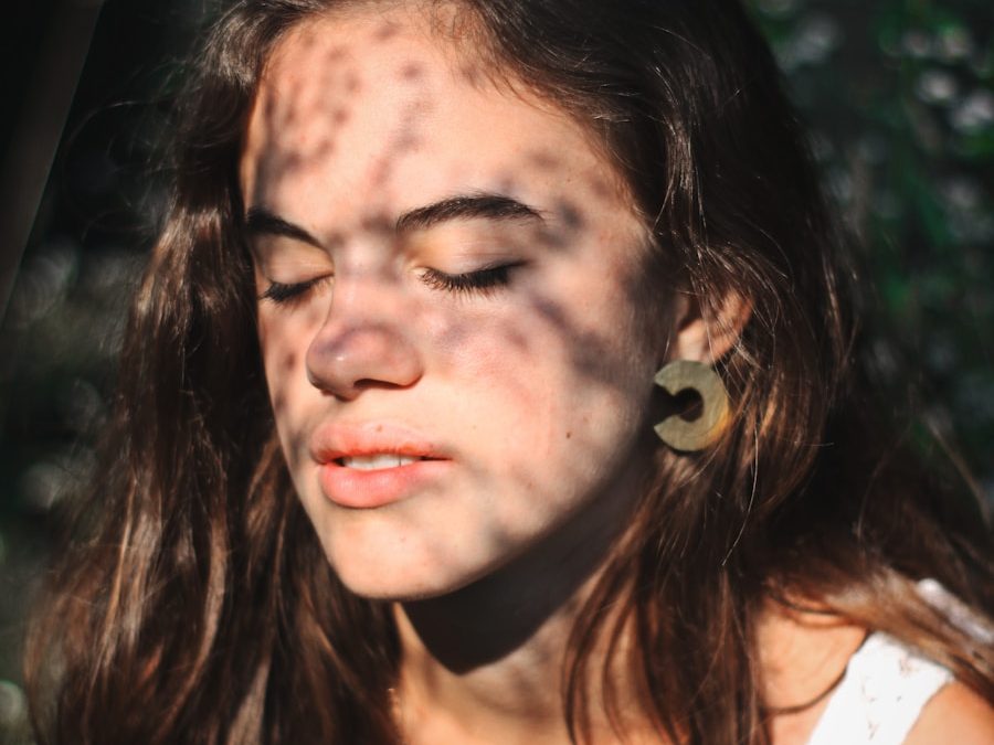 Photo "Dangers of birthmarks"
