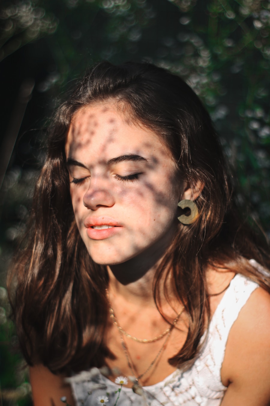 Photo "Dangers of birthmarks"