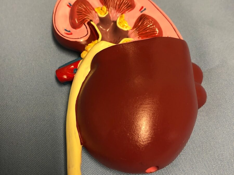 Photo "Complications of ARDS"