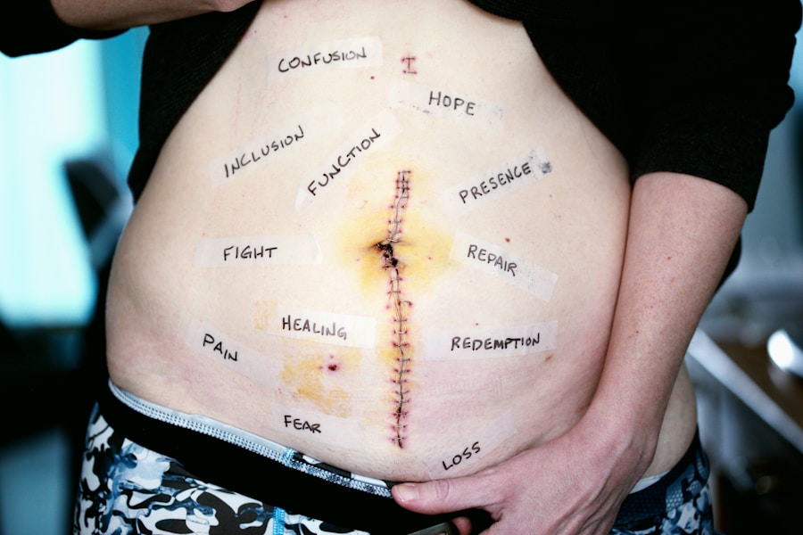 Photo Treatment of bulimia