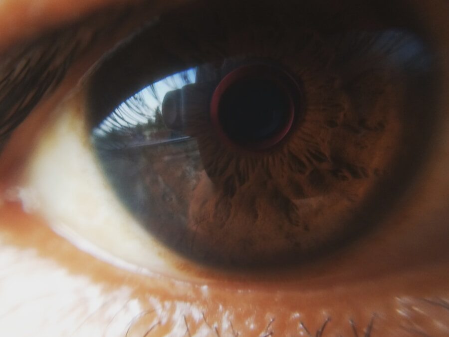 Photo Astigmatism