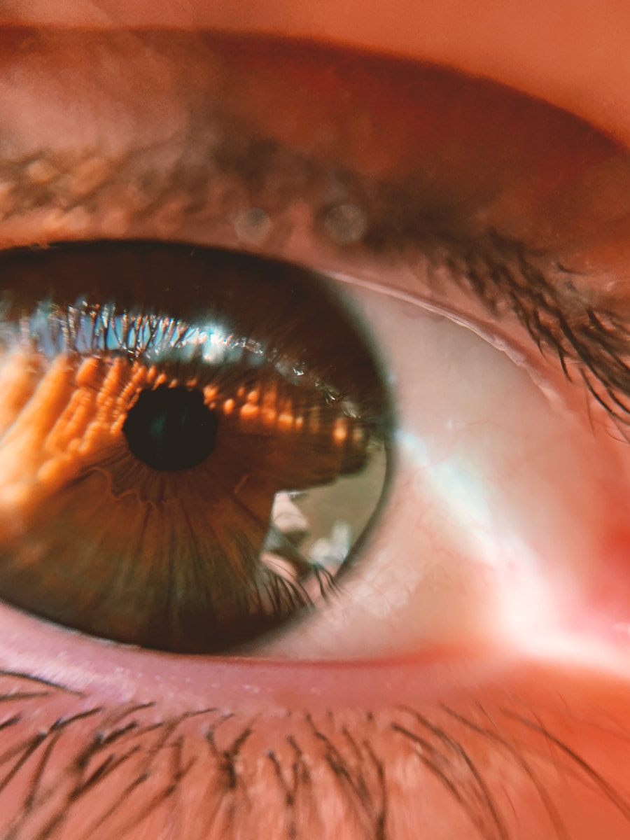 Photo Symptoms of astigmatism