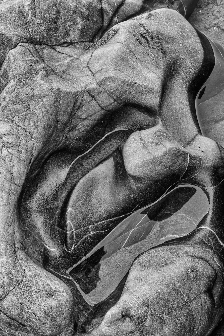 Photo Myocarditis