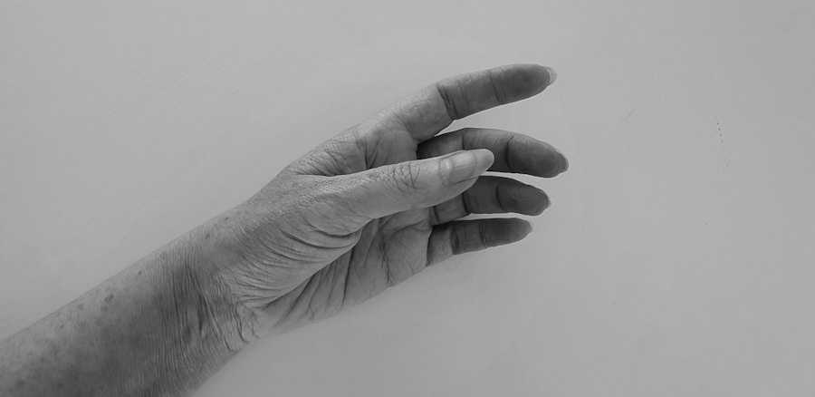 Photo Symptoms of carpal tunnel syndrome