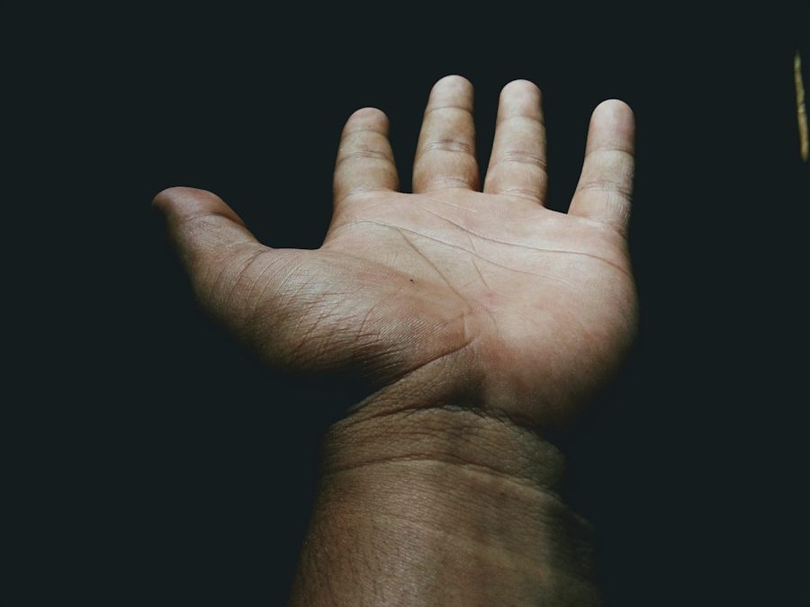 Photo Carpal tunnel syndrome