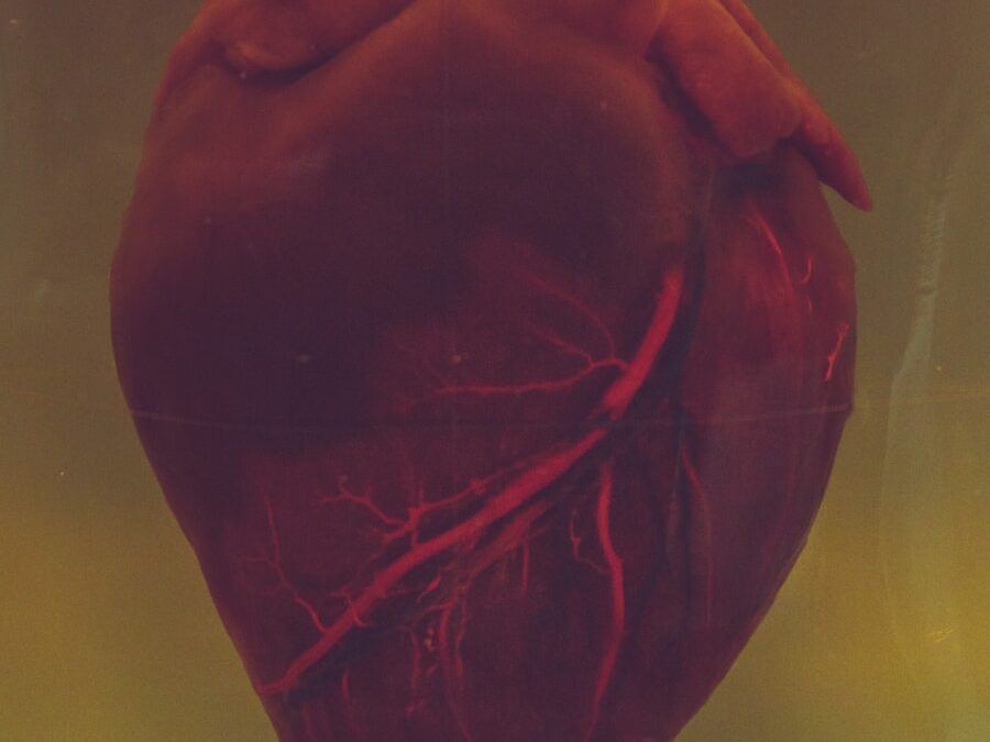 Photo Heart diseases