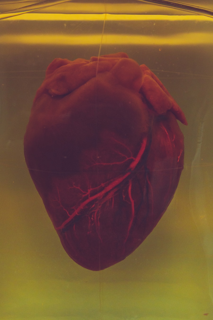 Photo Heart diseases