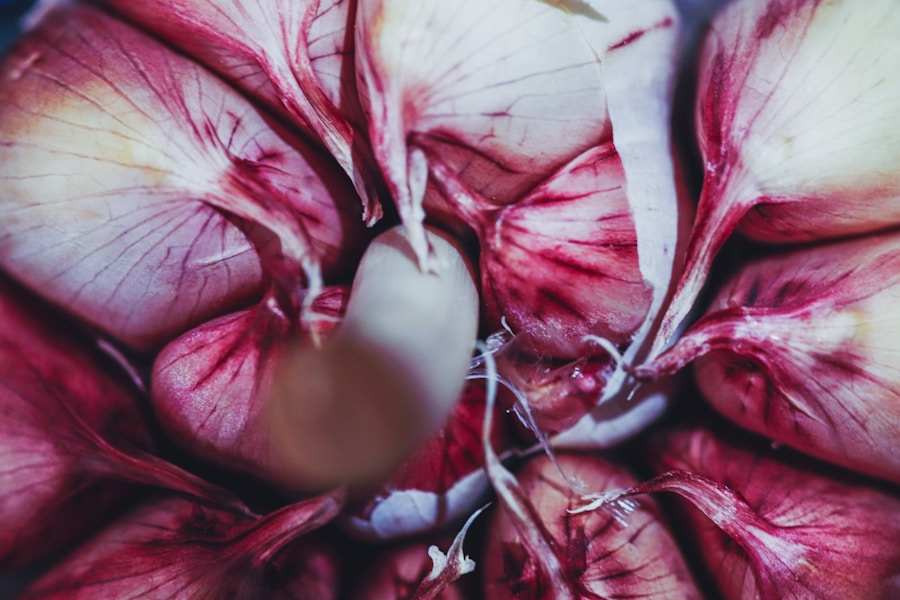 Photo Myocardial disease