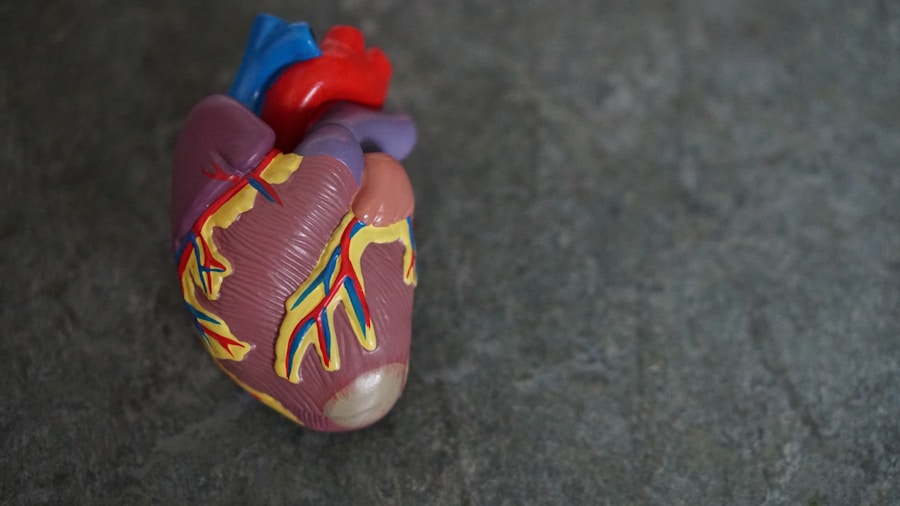 Photo Cardiomyopathy