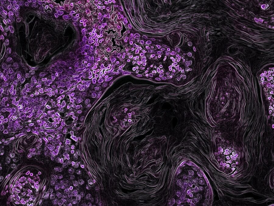 Photo Immune system