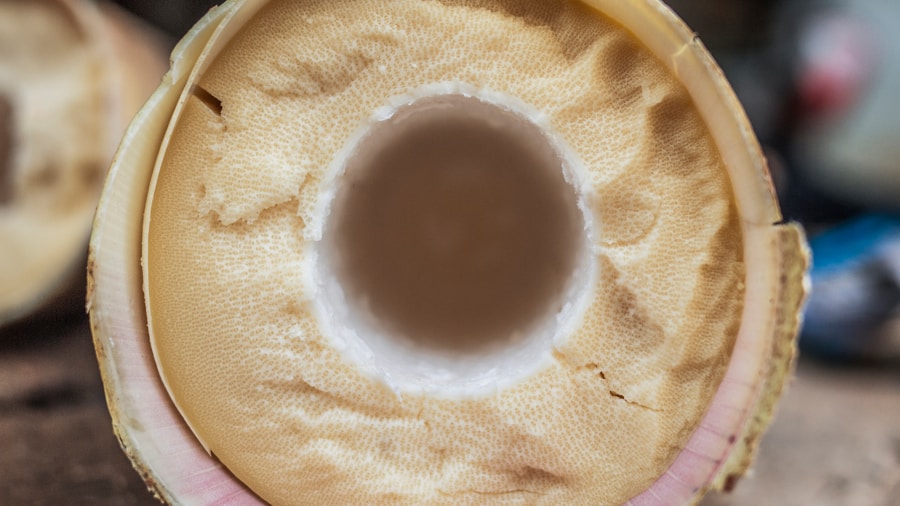 Photo Treatment of Bakers cyst
