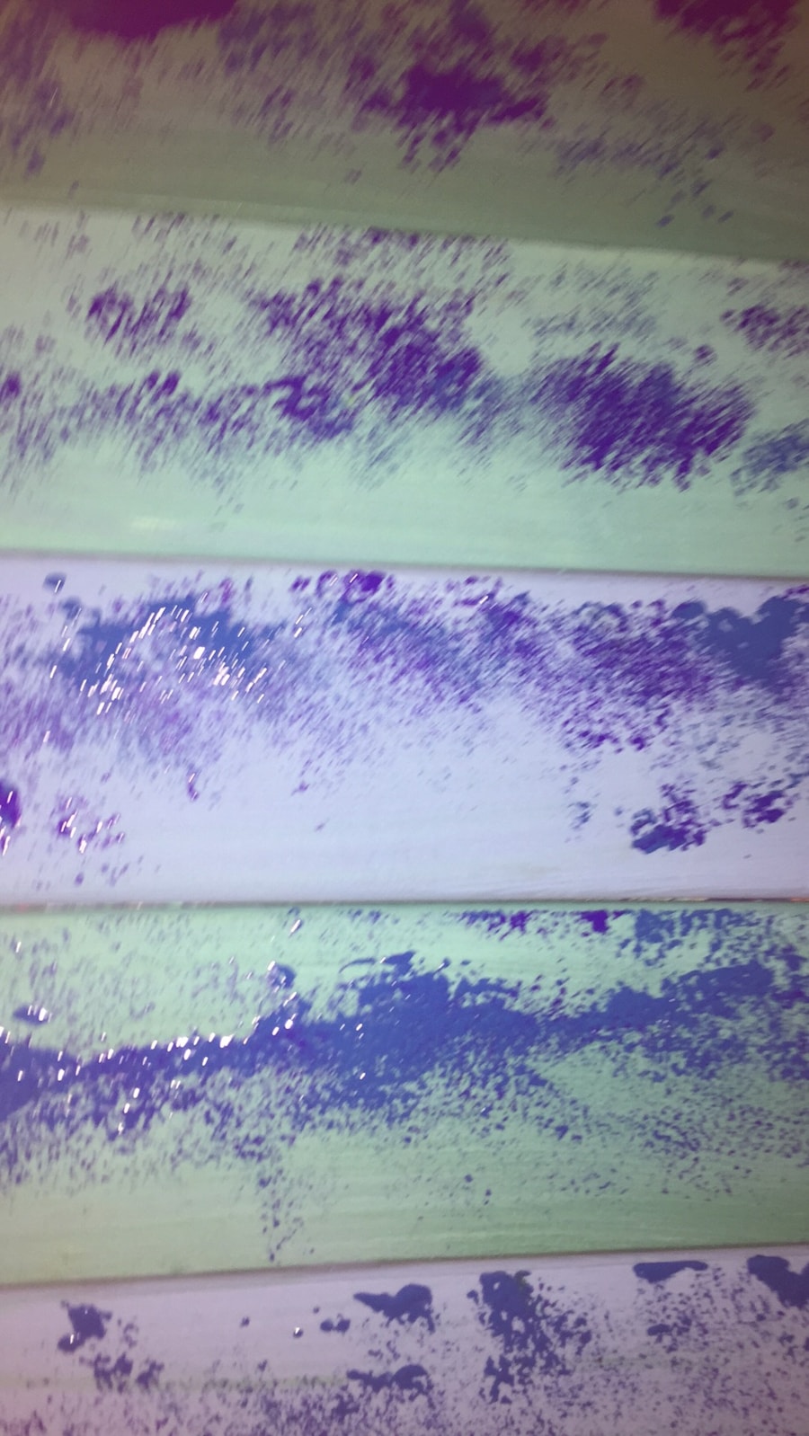 Photo "Bakers cyst diagnosis"