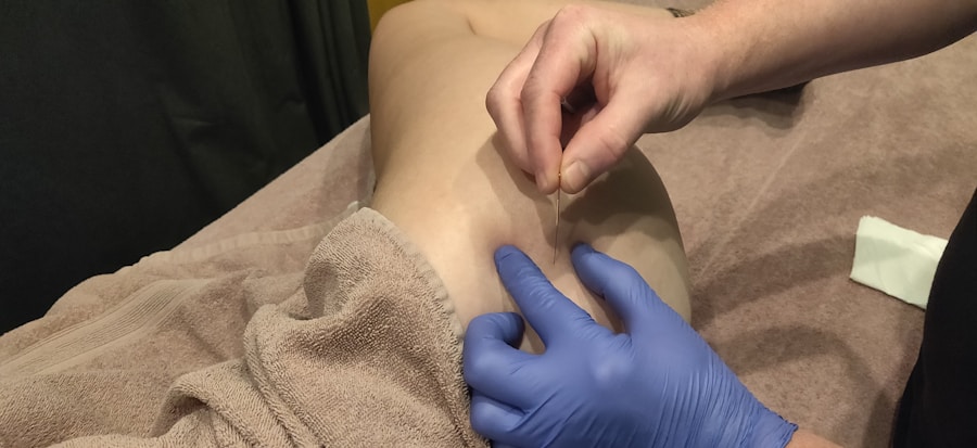 Photo Treatment of Bakers cyst