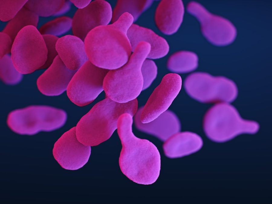 Photo Symptoms of Campylobacter infection