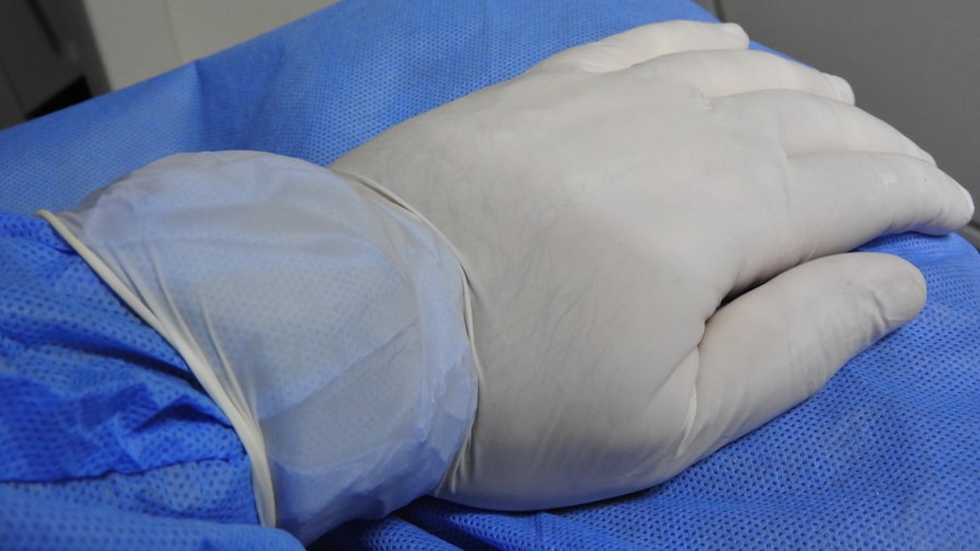 Photo Treatment of Bartholins cyst