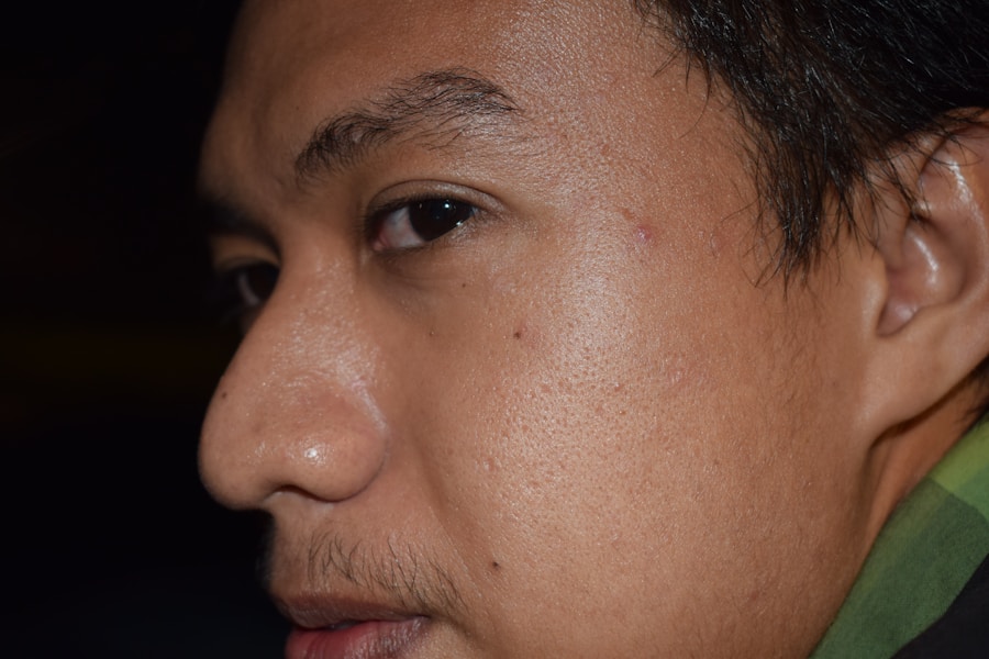 Photo "Types of basal cell carcinoma"