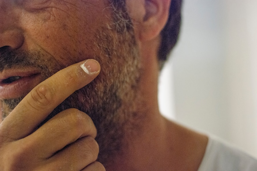 Photo "Risk factors for basal cell carcinoma"