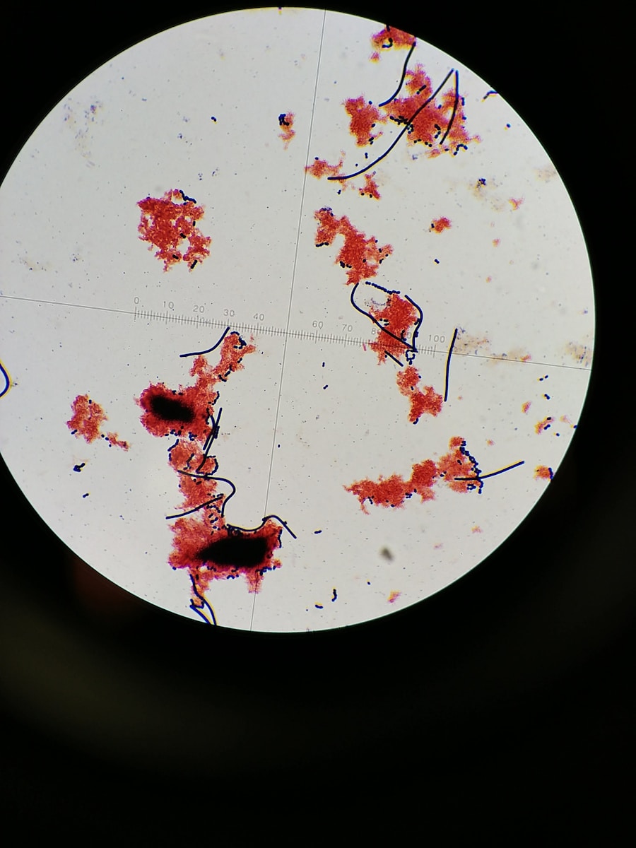 Photo "Cause of brucellosis"