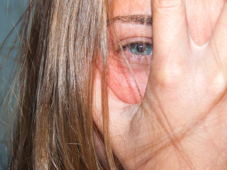 Photo Symptoms of BWS
