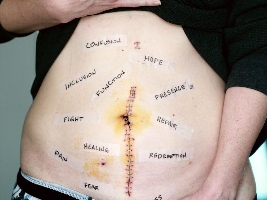 Photo "Symptoms of intestinal obstruction"