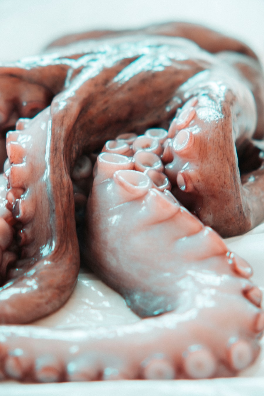Photo "Causes of intestinal obstruction"