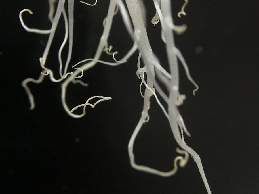 Photo Intestinal worms