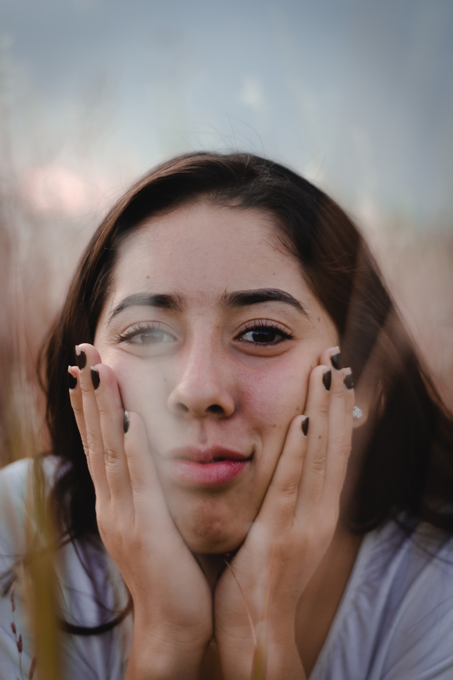 Photo Diagnosis of Bells palsy