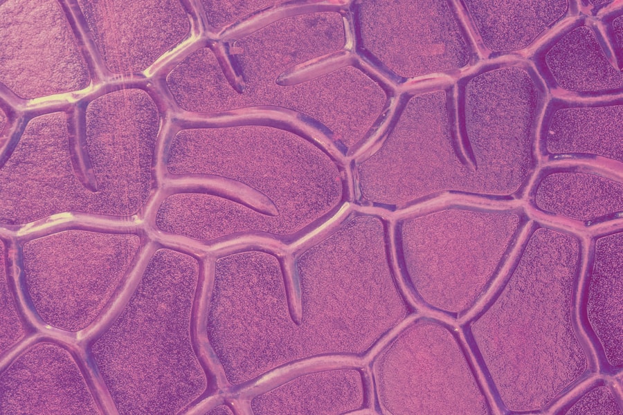 Photo "Development of skin fungus"
