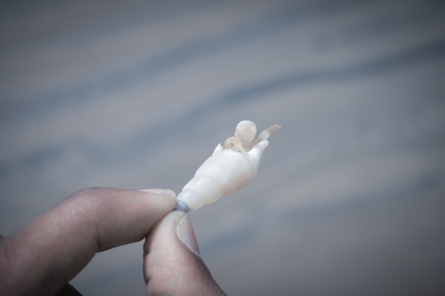 Photo Wisdom tooth removal