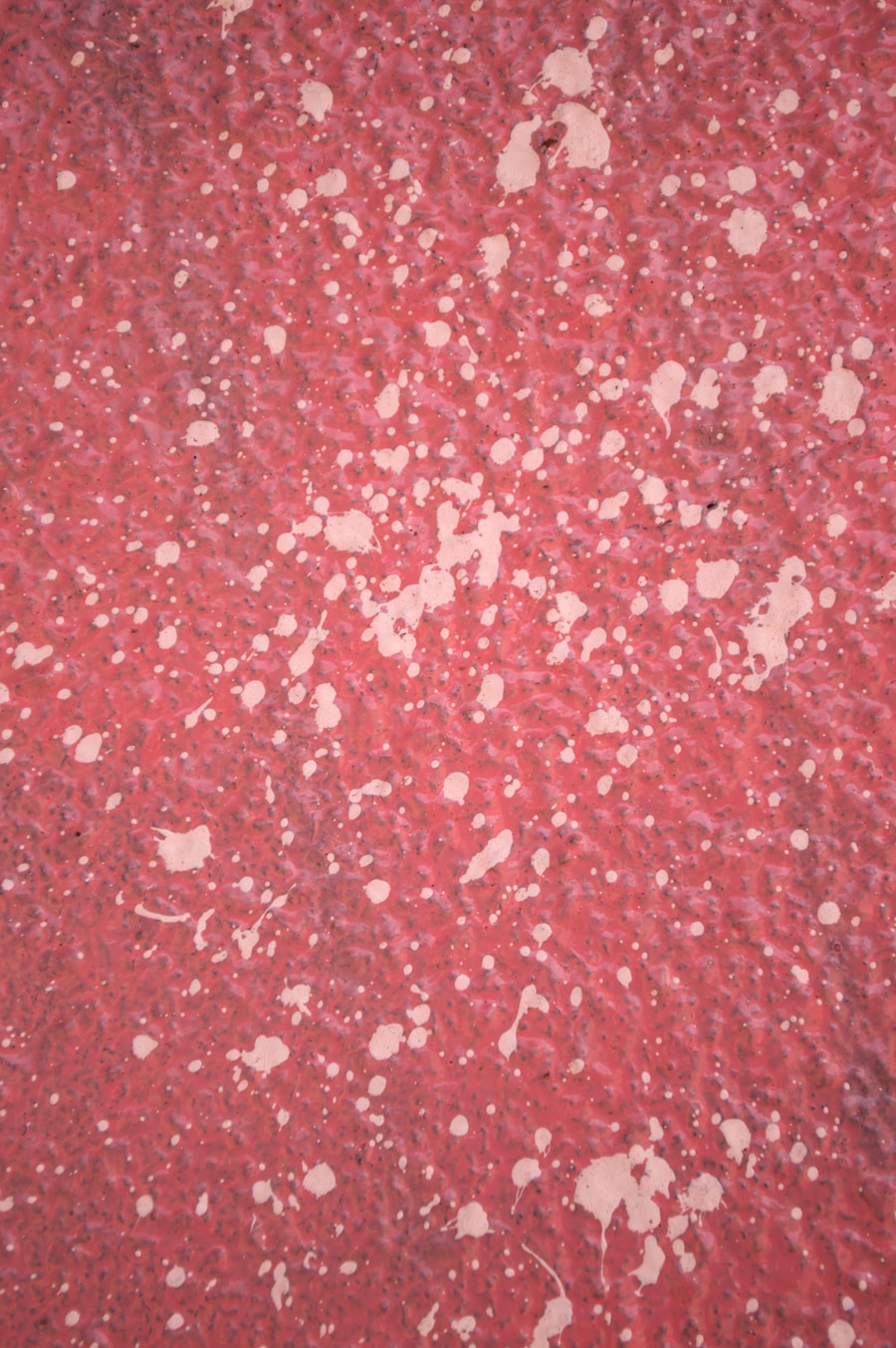 Photo Skin tumor