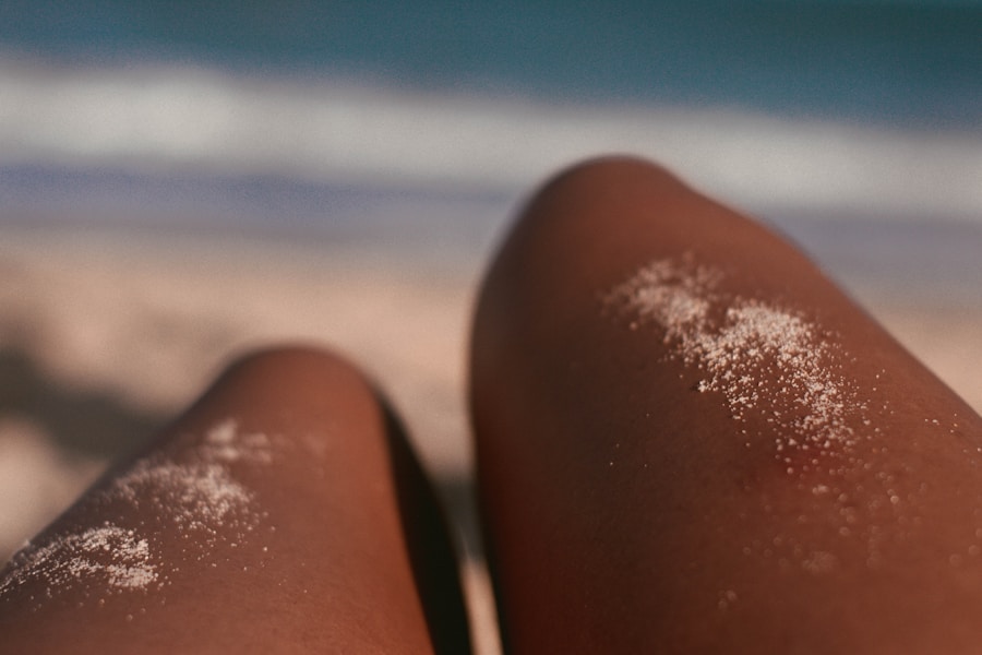 Photo "Prevention of skin cancer"