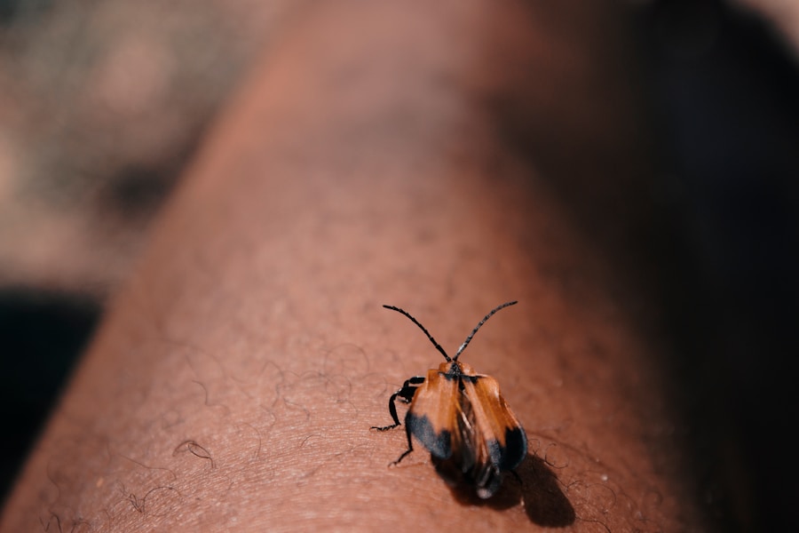 Photo Chagas disease epidemiology