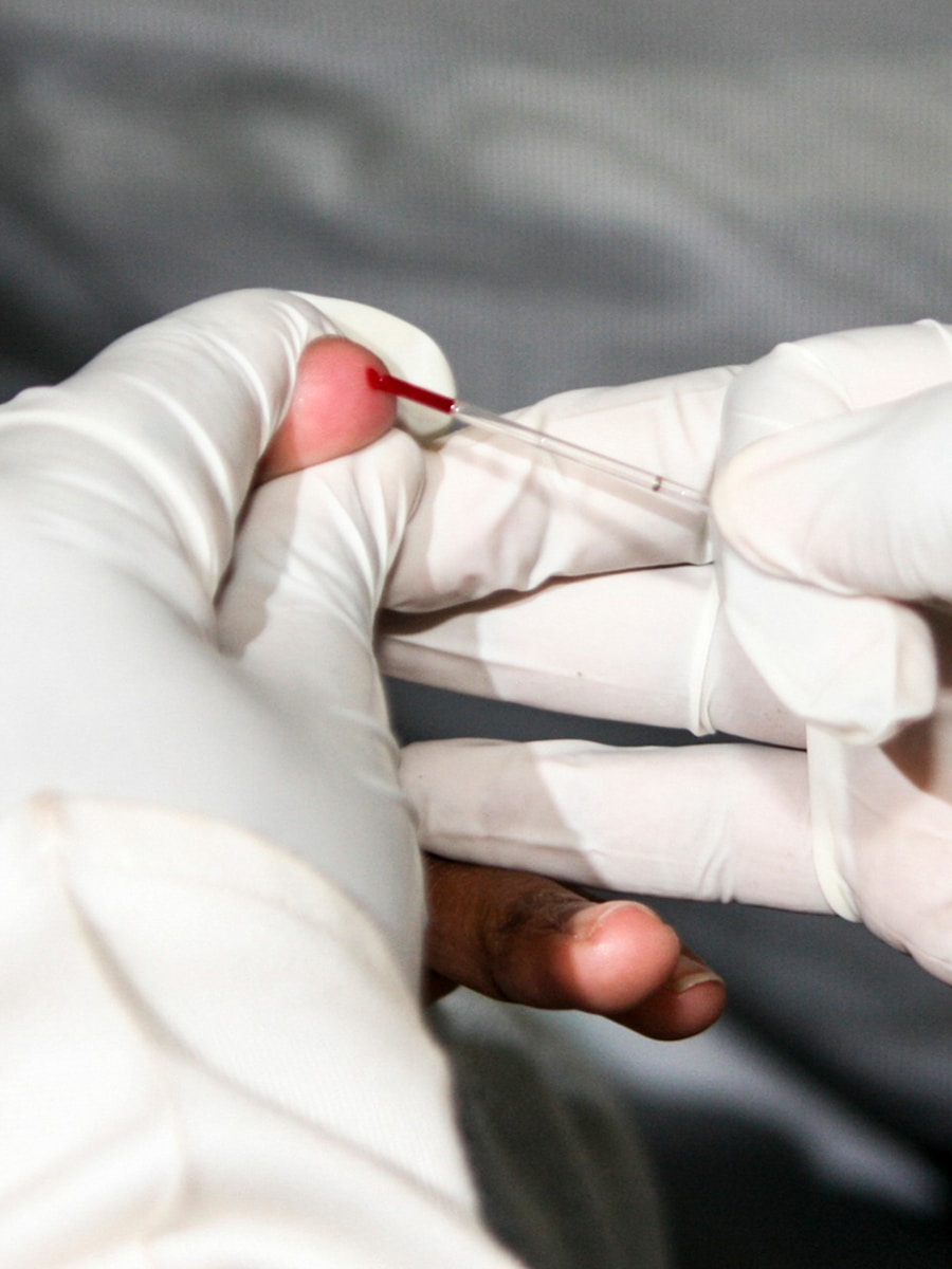 Photo "Symptoms of Chikungunya fever"