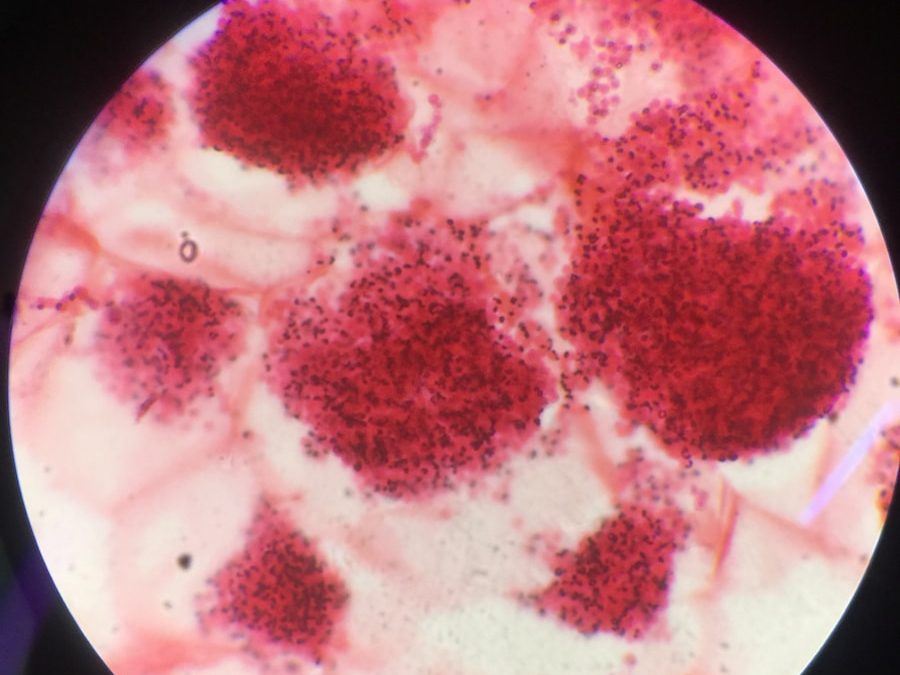 Photo "Transmission of Chlamydia trachomatis"