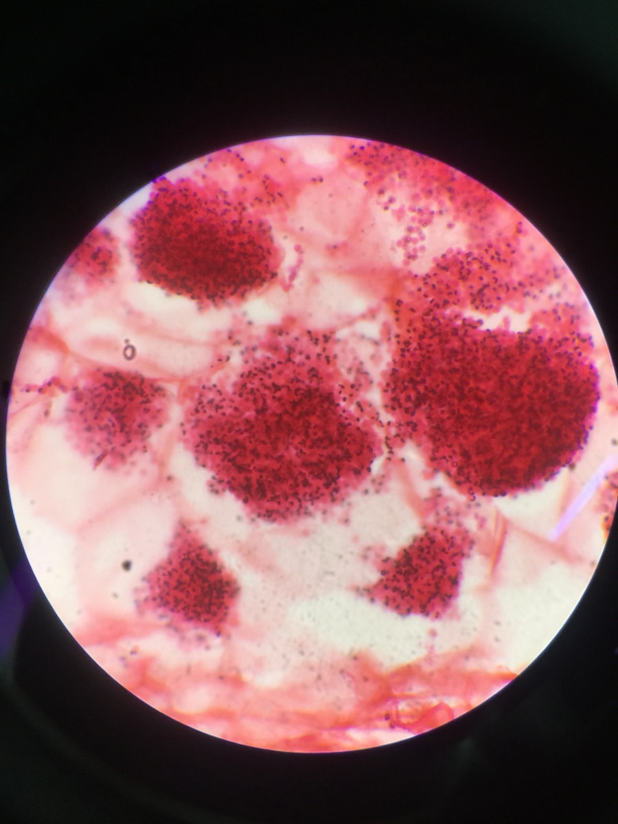 Photo "Transmission of Chlamydia trachomatis"
