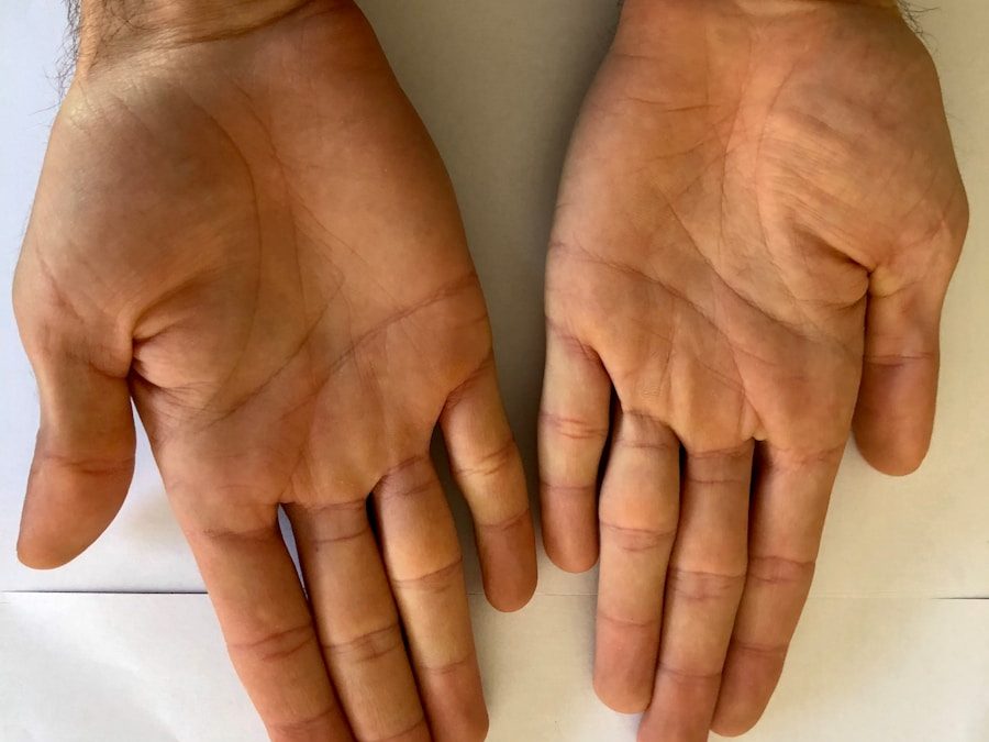 Photo Diagnosis of cyanosis