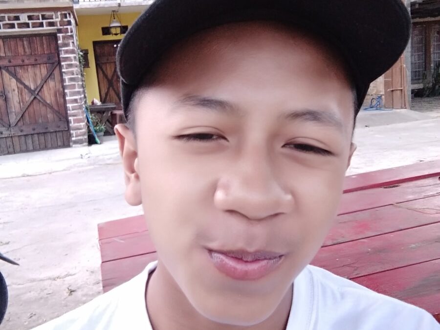 Photo Mental retardation