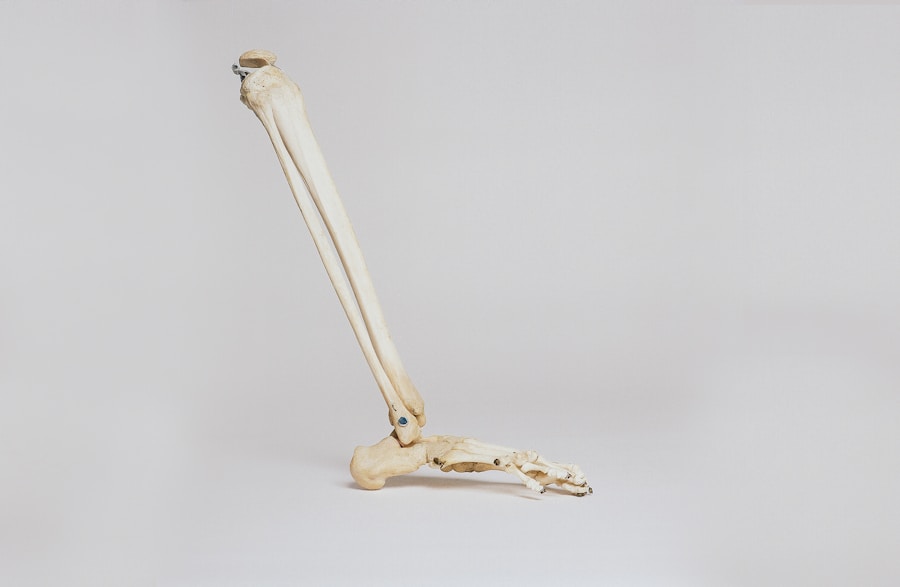 Photo Bone pain physiotherapy