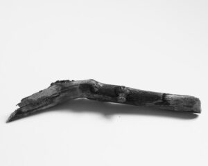 Photo Fracture of the femur