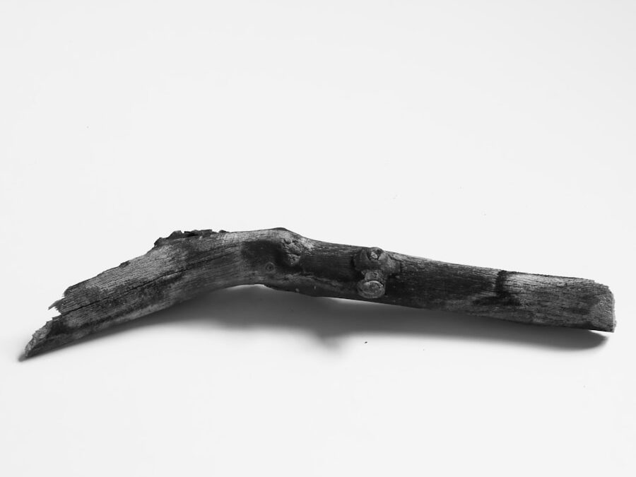 Photo Fracture of the femur