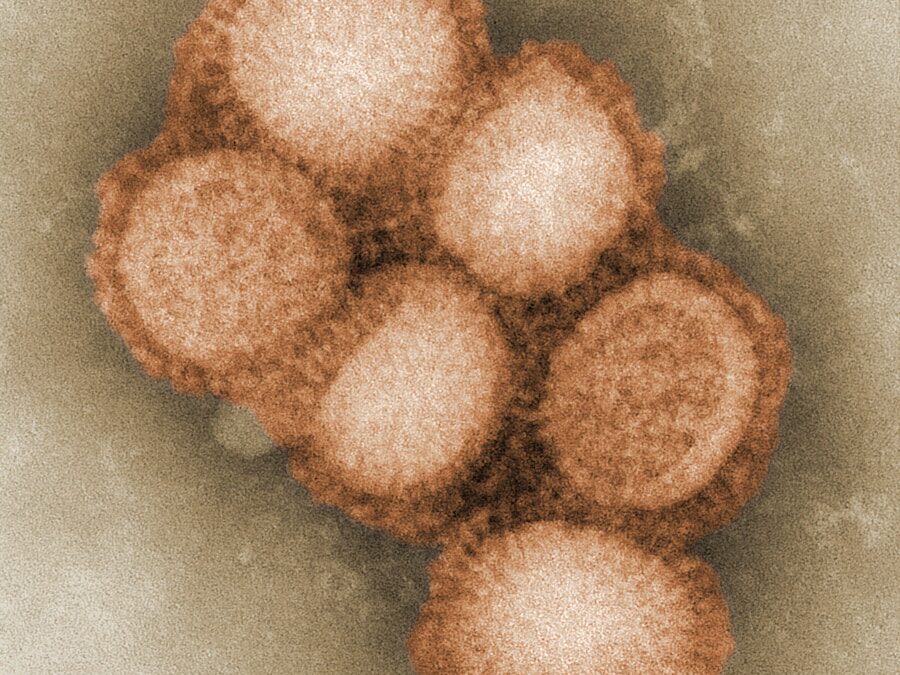 Photo Viral infection