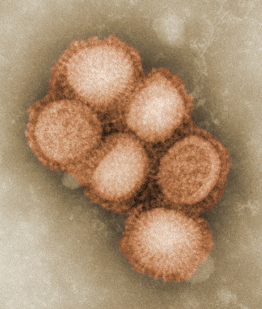 Photo Viral infection