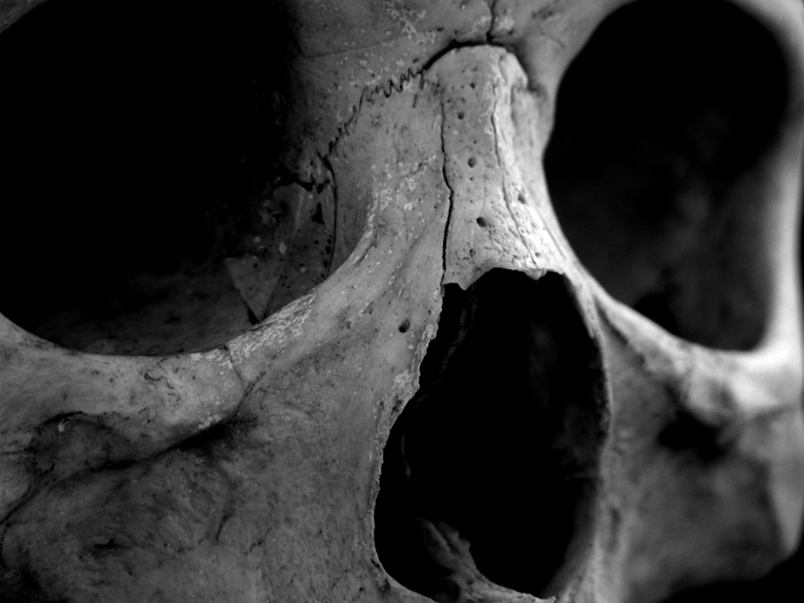 Photo Risk factors for bone cancer