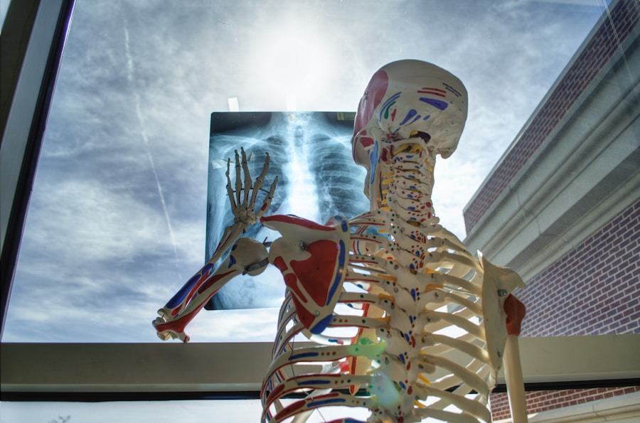 Photo "Costoclavicular syndrome physiotherapy"