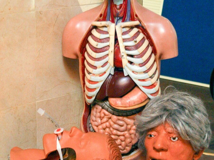 Photo "Causes of costoclavicular syndrome"