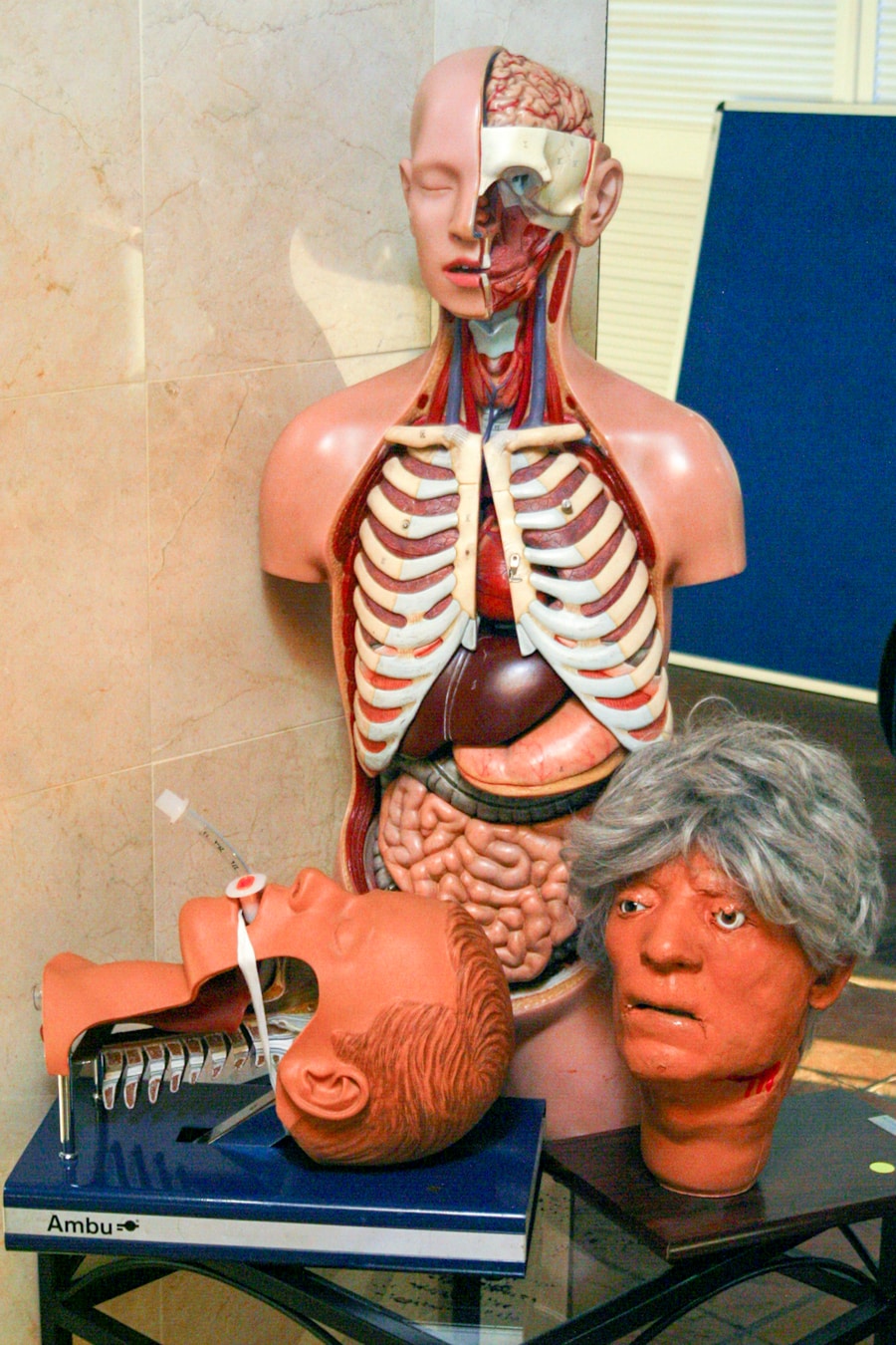 Photo "Causes of costoclavicular syndrome"