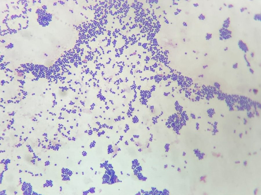 Photo Prion diseases