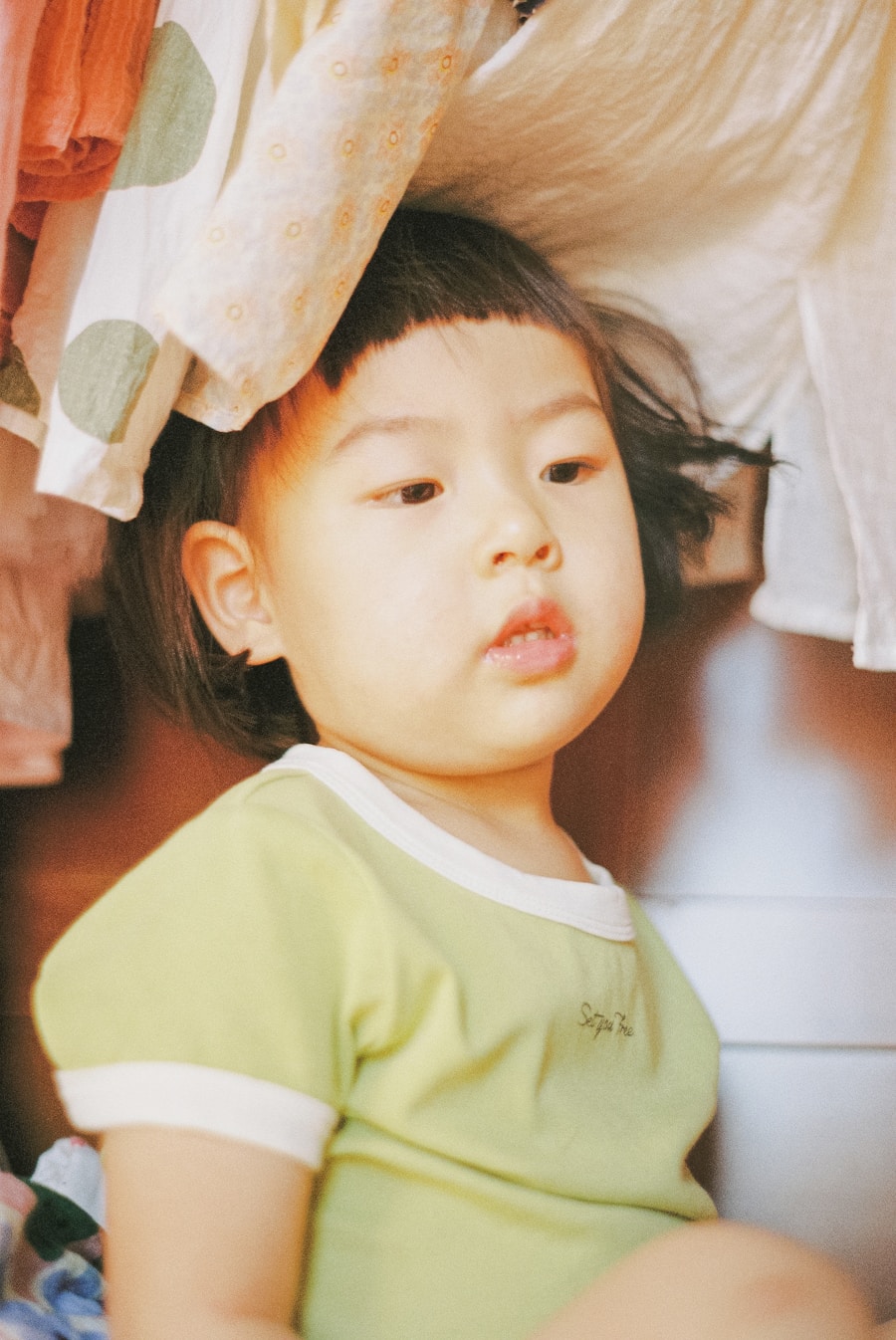 Photo Complications of Cri du chat syndrome