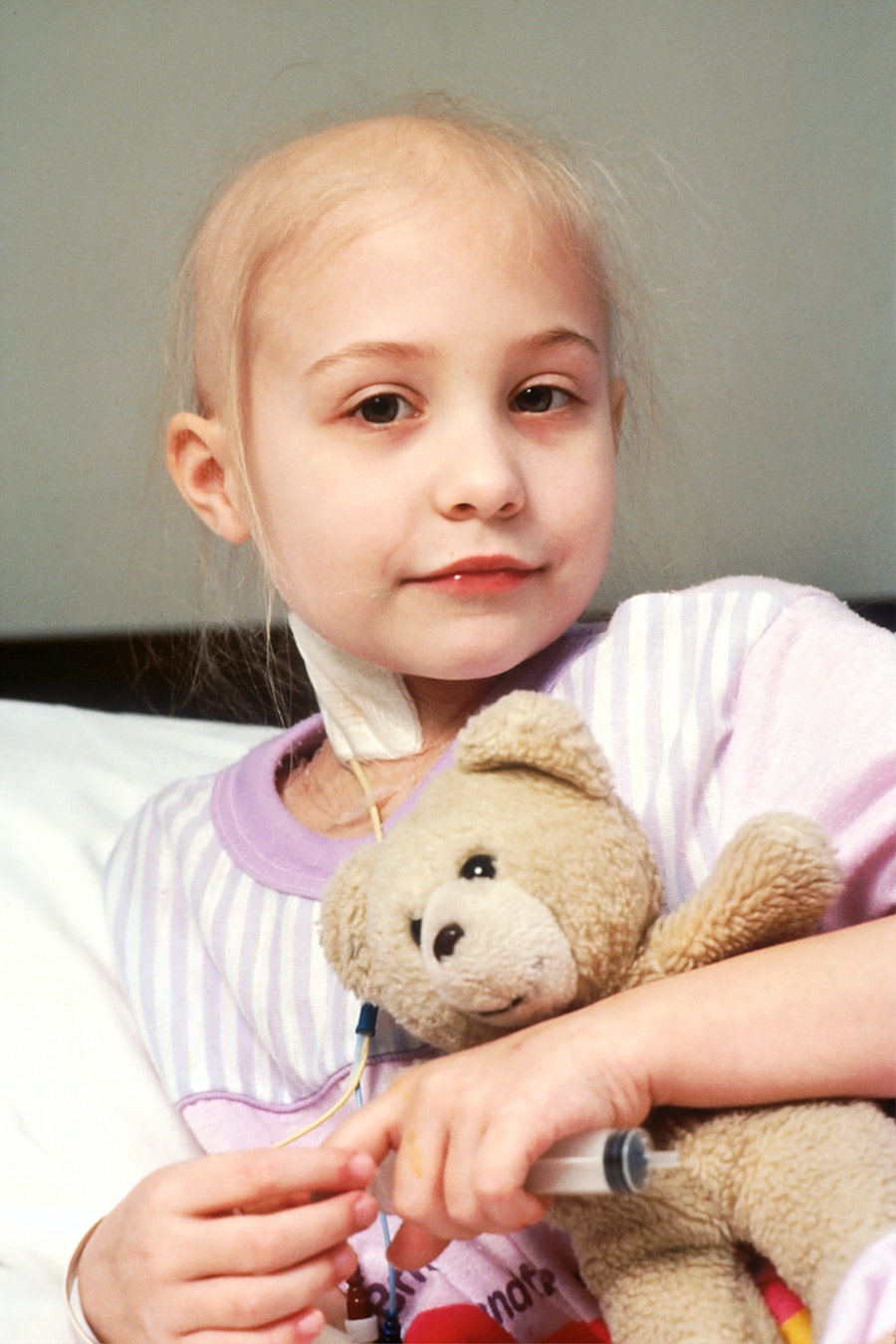 Photo Prevention of Cri du chat syndrome