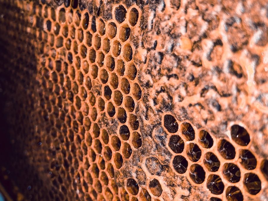 Photo "Diagnosis of hives"